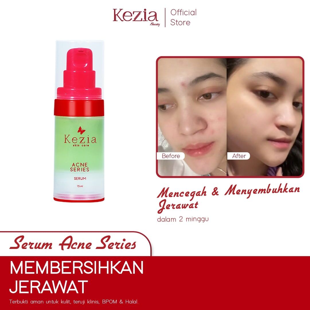 Acne kazia clearance